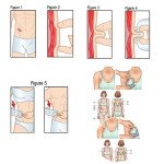 Μετρητής Λίπους Σώματος